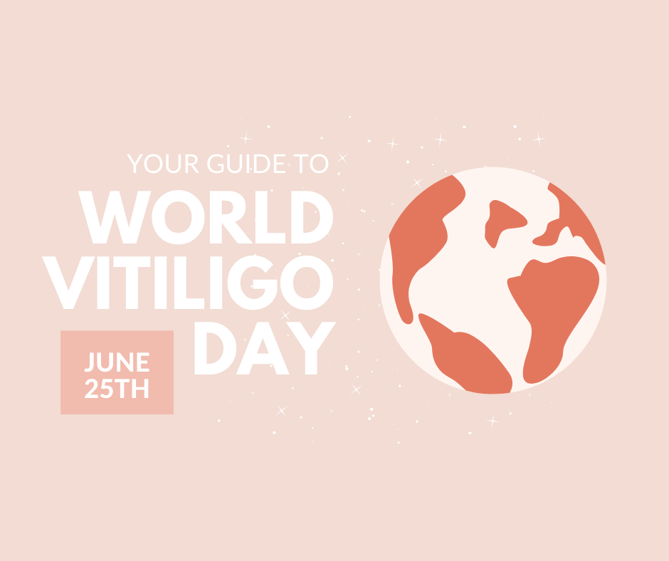 World Vitiligo Day Guide